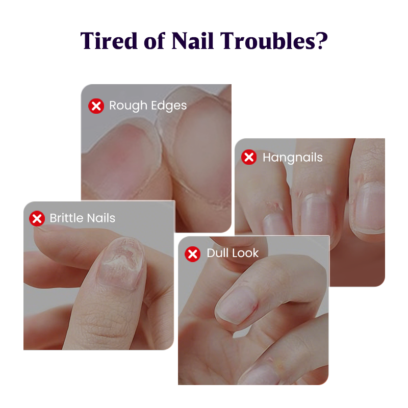 💅3-in-1 Nail Care Serum Oil Pen – Cuticle Remover, Nail Polish Remover & Nail Oil Treatment