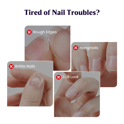 💅3-in-1 Nail Care Serum Oil Pen – Cuticle Remover, Nail Polish Remover & Nail Oil Treatment